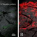神经胶质细胞引导脑血管发育的研究