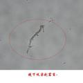 唐山市周边农村女性阴道霉菌感染影响因素调查