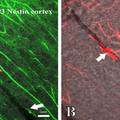 神经胶质细胞引导脑血管发育的研究