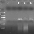 黄河裸裂尻生长激素基因的PCR扩增和克隆