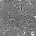 骨髓基质干细胞的分离培养、定向诱导及实验治疗的研究