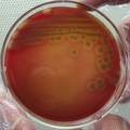 C型肉毒梭菌的分离及肉毒毒素的制备、鉴定