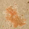 柯萨奇病毒B组3型感染胰岛细胞的体外研究
