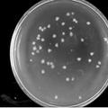 新型微生物溶栓酶的开发