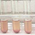 新型微生物溶栓酶的开发