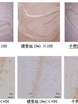 环境污染物氯化甲基汞慢暴露对新生鼠记忆损伤及枸杞多糖干预的实验研究